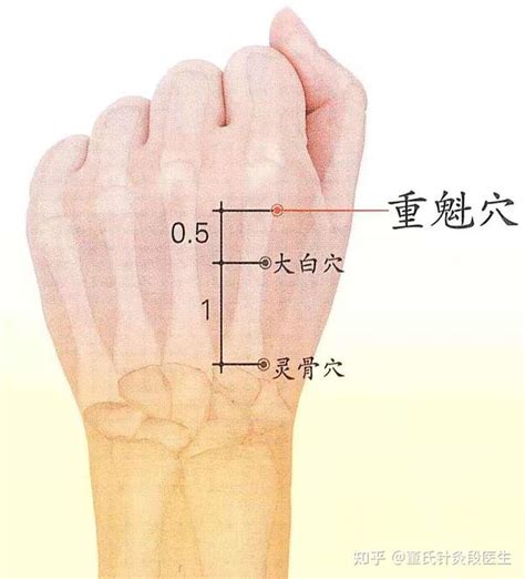 重魁穴|董氏针灸林正泰案例分享之【灵骨大白重魁穴】！